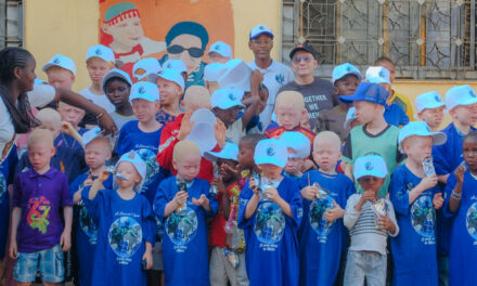 Guinée : Une coalition humanitaire expose les réalités douloureuses des enfants albinos