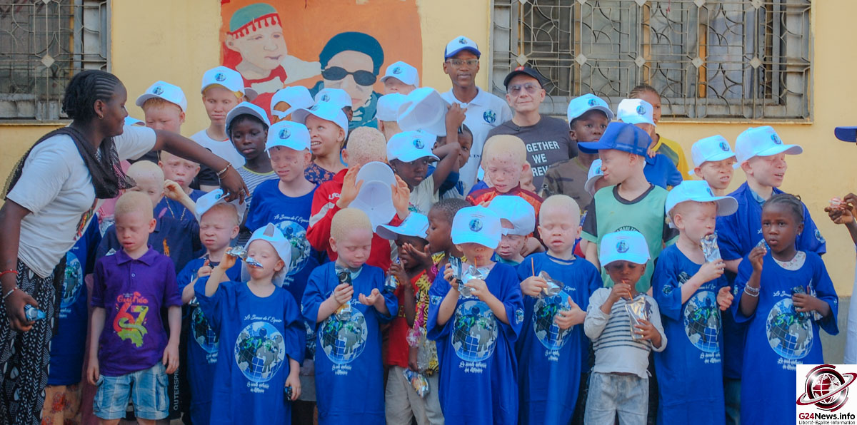 Guinée : Une coalition humanitaire expose les réalités douloureuses des enfants albinos