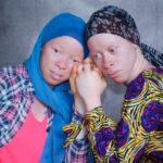 Guinée : à Nongo, une mobilisation citoyenne forte pour la dignité et l’inclusion des personnes atteintes d’albinisme