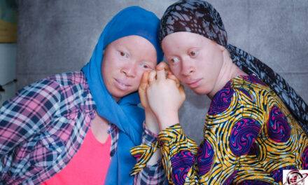 Guinée : à Nongo, une mobilisation citoyenne forte pour la dignité et l’inclusion des personnes atteintes d’albinisme