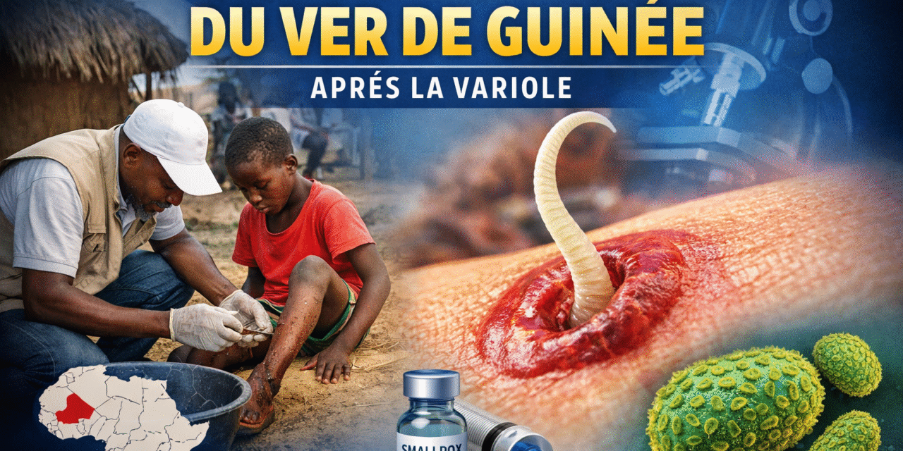 Guinée et monde : le ver de Guinée sur le point d’être éradiqué